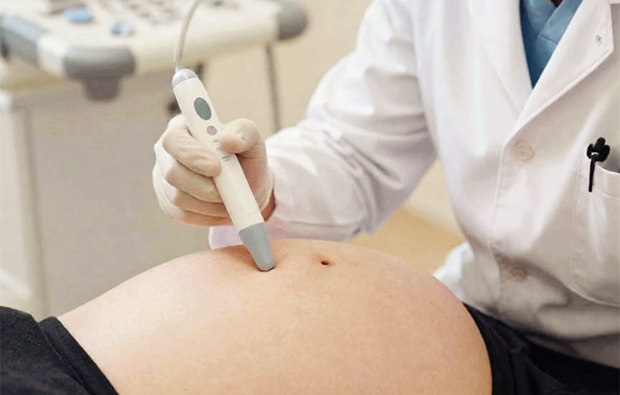 到美国生宝宝专属于孕妈的优待体验 